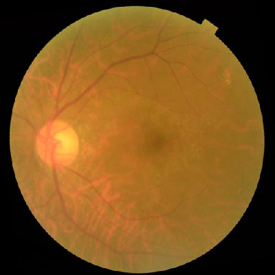 augmented_image_133.jpg