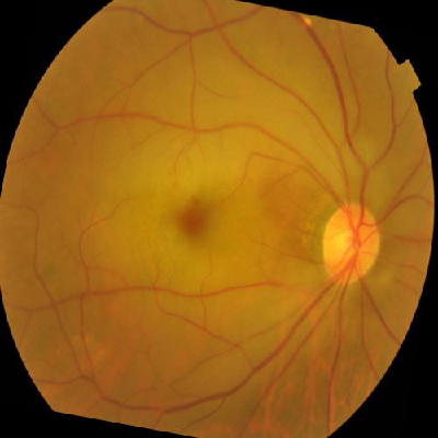 augmented_image_400.jpg