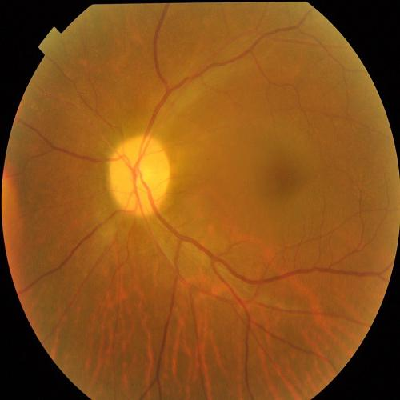 augmented_image_115.jpg