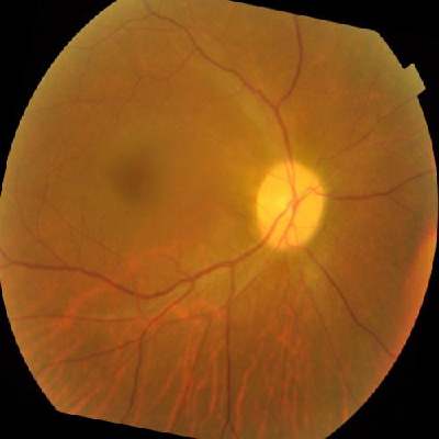 augmented_image_359.jpg