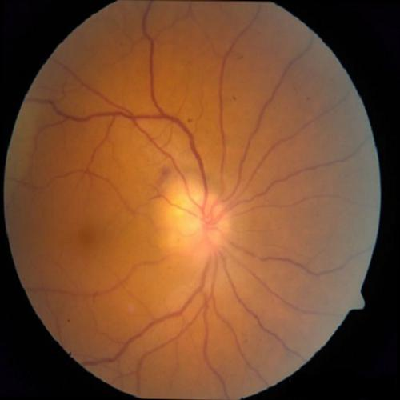 augmented_image_446.jpg